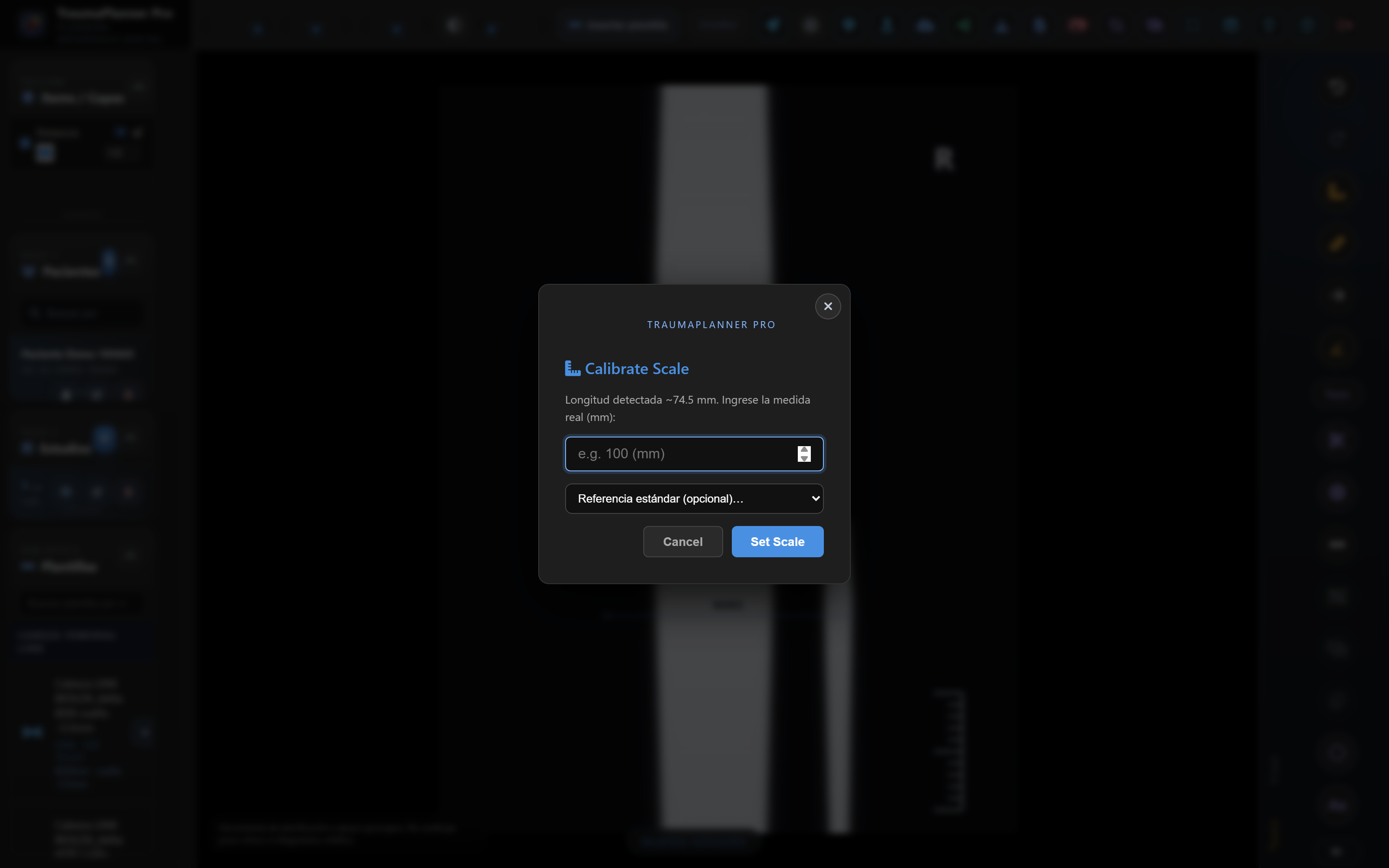 Modal de calibración con la referencia anatómica estándar seleccionada y el valor en milímetros a introducir.